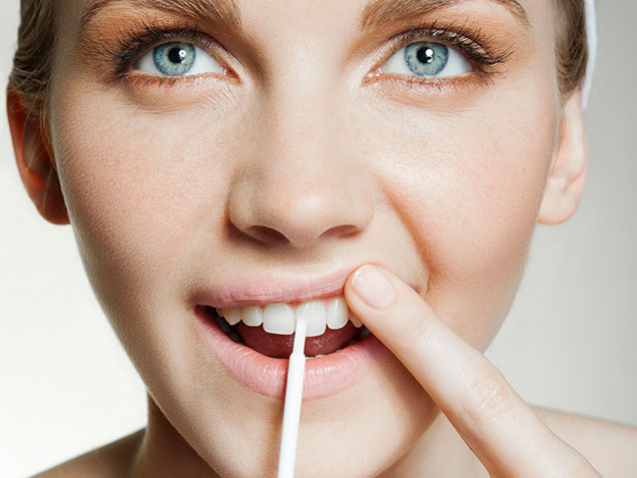 toothbleeching_aligner1